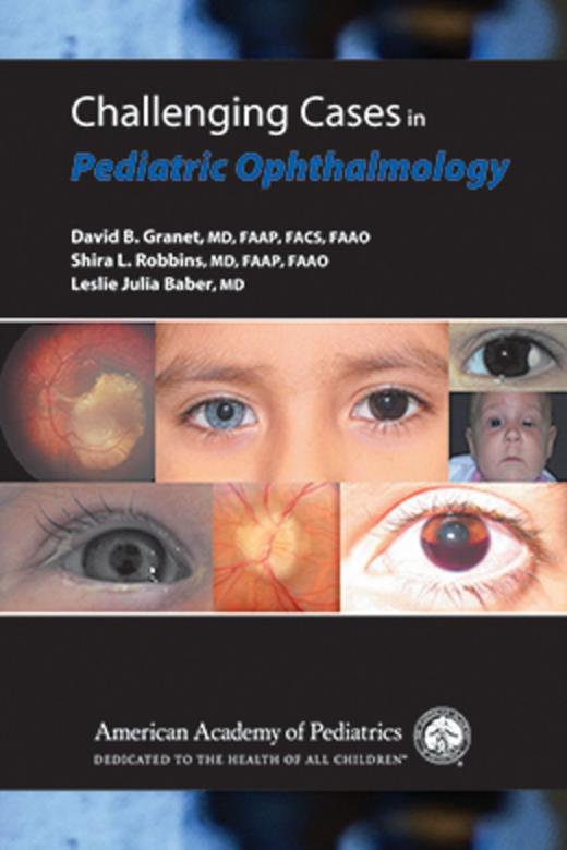 Book cover for Challenging Cases in Pediatric Ophthalmology