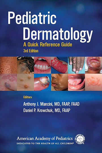 Stevens-Johnson Syndrome (SJS) | Pediatric DermatologyA Quick Reference ...