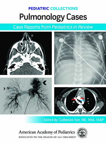 Book cover for Pediatric Collections: Pulmonology Cases