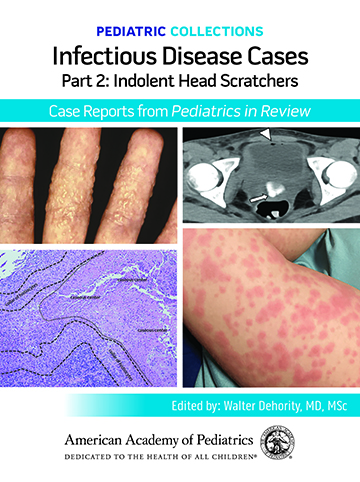 Book cover for Pediatric Collections: Infectious Diseases, Part 2: Indolent Head Scratchers