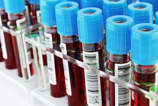 Vials of blood