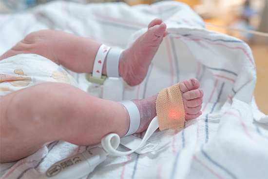 AAP updates recommendations on use of pulse oximetry to screen newborns ...