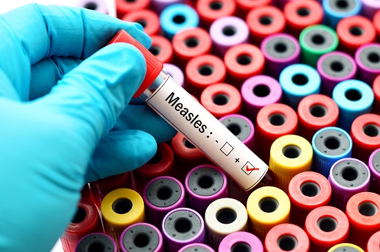 A gloved hand pulls a vial labeled "Measles" from a rack of dozens of vials with colorful toppers.
