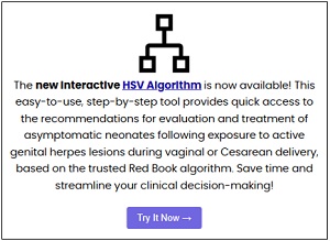 Description of HSV interactive algorithm on RBO.