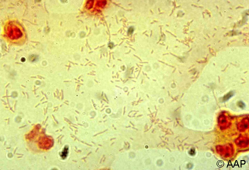 Gram stain of cerebrospinal fluid.