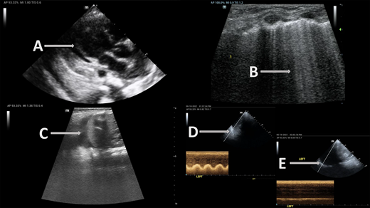 Point-of-Care Ultrasound in Children With Medical Complexity | Hospital ...