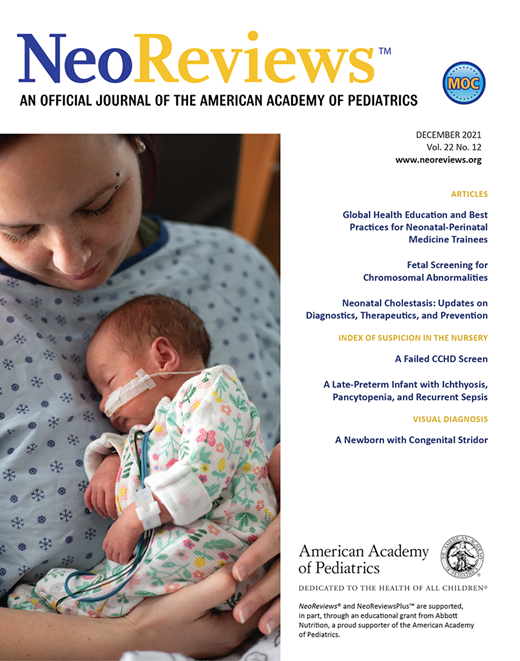 Absent Red Reflexes and Cloudy Corneas NeoReviews American Academy