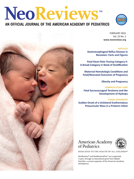 Fetal Sacrococcygeal Teratoma and the Development of Hydrops