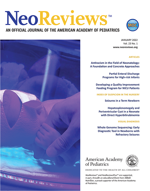 A Floppy Infant with Facial Dysmorphism NeoReviews American Academy