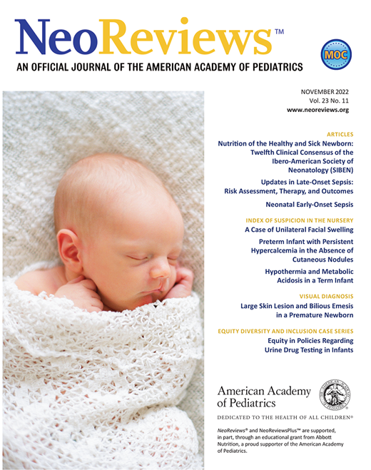 Updates in Late-Onset Sepsis: Risk Assessment, Therapy, and Outcomes ...
