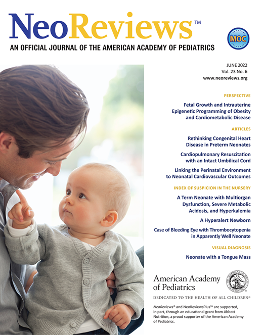 Rethinking Congenital Heart Disease in Preterm Neonates NeoReviews