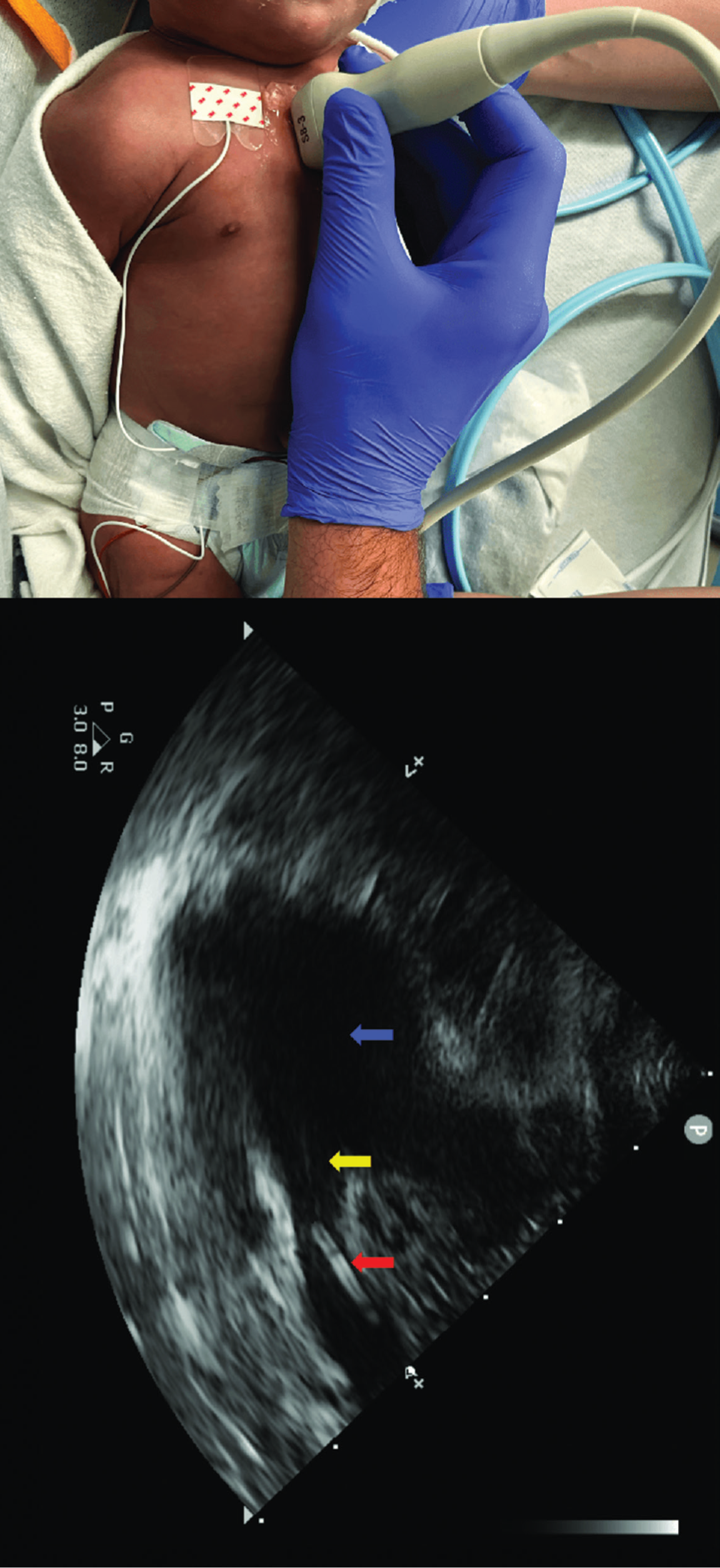 Browse Covers | NeoReviews | American Academy of Pediatrics