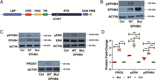 EPHB4 mutant abolishes signal when transfected into human cells. A, EPHB4 domain map with the mutation shown at amino acid 700 in the kinase domain. B–D, Cells were transfected with wild-type (WT) and mutant (mut) EPHB4 alleles, and lysates were used after 48 hours. B, HEK293 cell culture lysates were used to obtain EPHB4 phosphorylation and EPHB4 by immunoblot (n = 3). C and D, Human lung endothelial cell lysates were used to immunoblot for the phosphorylation of EPHB4 (pEPHB4) and ERK (pERK), as well as EPHB4, ERK, and PROX1, with densitometry shown graphically (n = 4). ***P < .001. CRD, C-type carbohydrate recognition domain; Ctrl, control; FNIII, fibronectin type III; LBP, lipopolysaccharide-binding protein; PMB, pseudomurein cell wall binding; RTK, receptor tyrosine kinase; SAM, sterile alpha motif; TM, transmembrane.