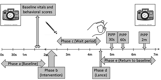 25% Dextrose Versus 24% Sucrose for Heel Lancing in Preterm Infants: A ...